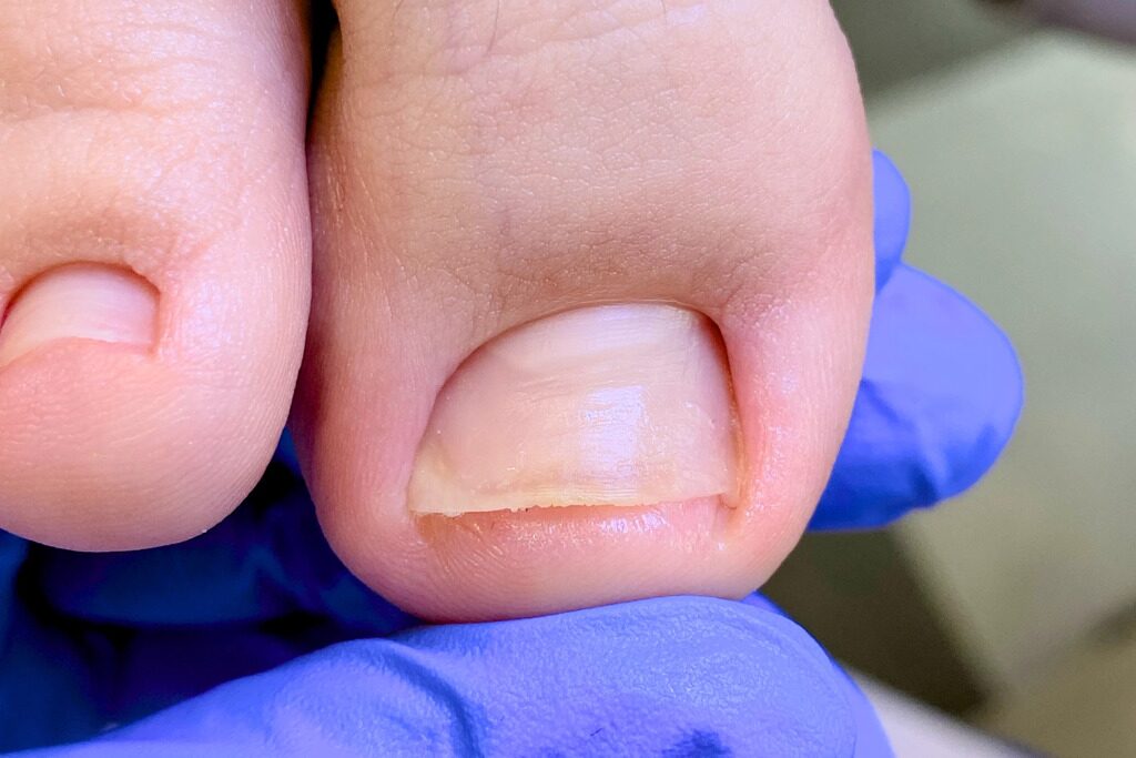 Ровный ноготь